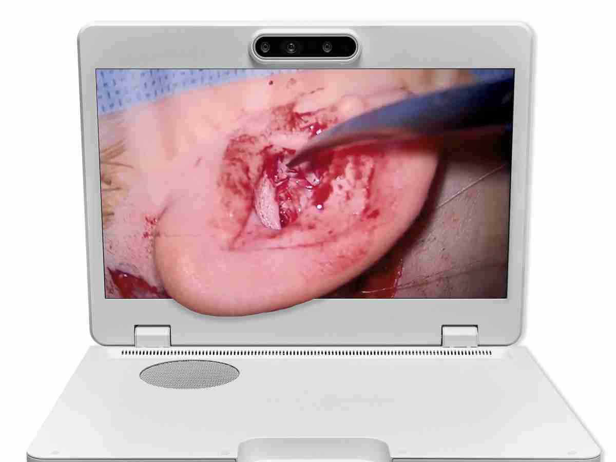 达擎之＂Heads-up 3D显微手术显示系统＂，，整合4K裸眼3D显示及眼球追踪系统，，，，具备快速追踪人眼移动位置功能，，，，减轻医师长时间维持固定姿势的负担，，，，让医师能有更宽广清晰的3D立体视野及更舒适的姿势来执行手术。。。。